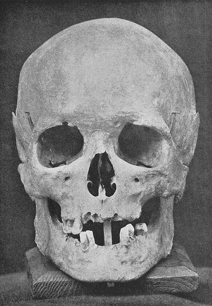 Bach's skull, found in 1894